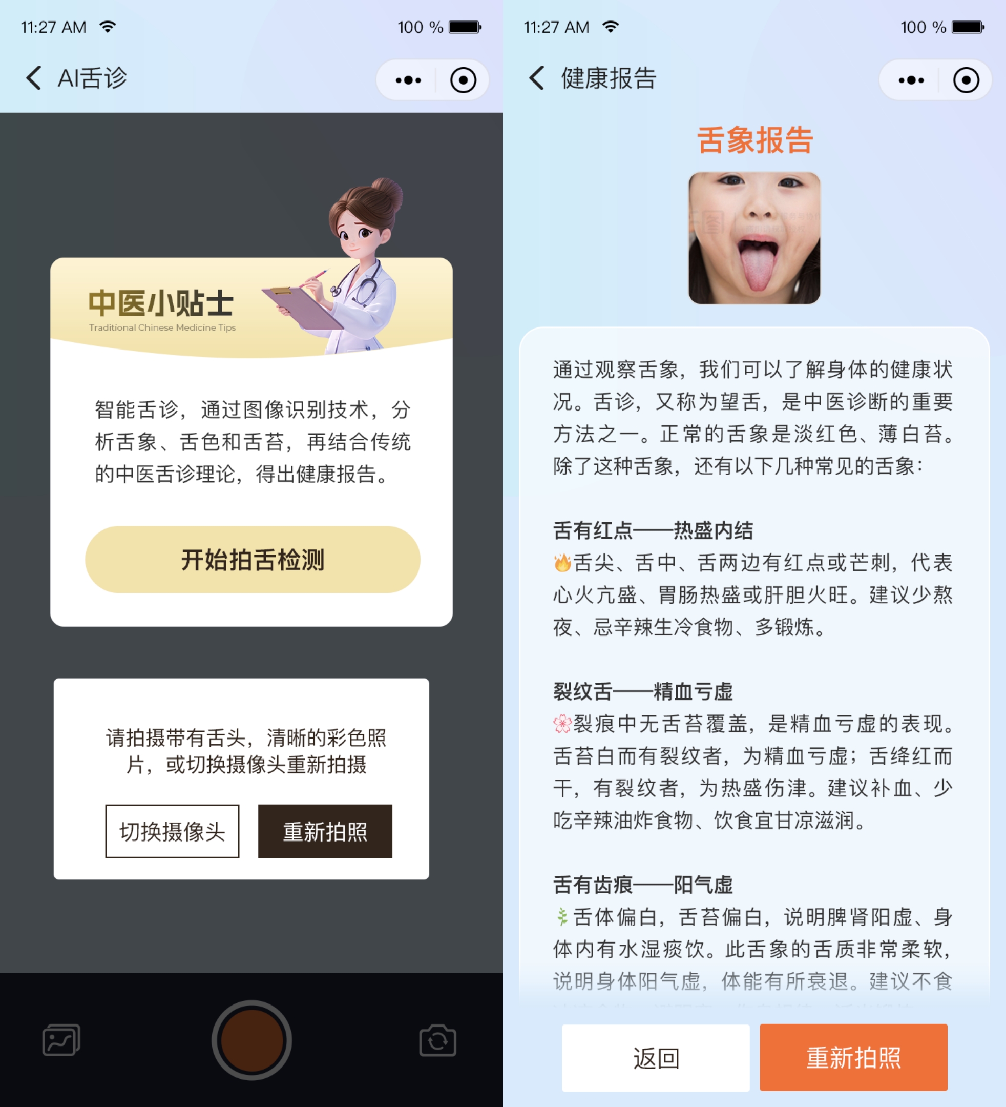 AI舌诊